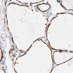 ASMTL Antibody in Immunohistochemistry (IHC)