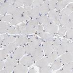 ASMTL Antibody in Immunohistochemistry (IHC)