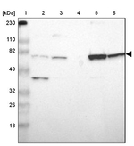 ASMTL Antibody in Western Blot (WB)
