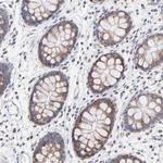 ICT1 Antibody in Immunohistochemistry (Paraffin) (IHC (P))