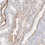 ICT1 Antibody in Immunohistochemistry (Paraffin) (IHC (P))