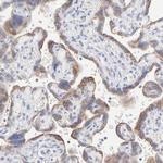 ICT1 Antibody in Immunohistochemistry (Paraffin) (IHC (P))
