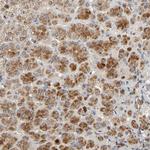 C14orf119 Polyclonal Antibody