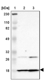 DNAL4 Antibody in Western Blot (WB)