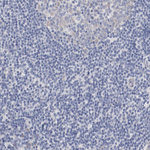 GPR143 Polyclonal Antibody