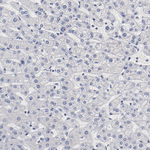 GPR143 Antibody in Immunohistochemistry (Paraffin) (IHC (P))
