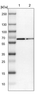RGAG4 Antibody in Western Blot (WB)