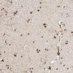 RGAG4 Antibody in Immunohistochemistry (IHC)