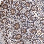 GS2 Polyclonal Antibody