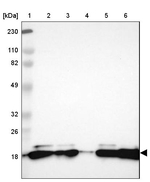 GS2 Antibody in Western Blot (WB)
