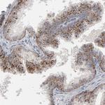 POMT2 Polyclonal Antibody