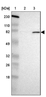 POMT2 Antibody in Western Blot (WB)