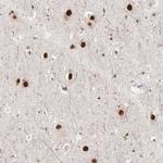 ZNF3 Antibody in Immunohistochemistry (Paraffin) (IHC (P))