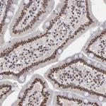 ZNF3 Antibody in Immunohistochemistry (Paraffin) (IHC (P))