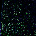 ZNF3 Antibody in Immunohistochemistry (Paraffin) (IHC (P))