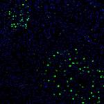 ZNF3 Antibody in Immunohistochemistry (Paraffin) (IHC (P))