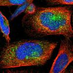 YIPF6 Polyclonal Antibody