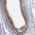 YIPF6 Antibody in Immunohistochemistry (Paraffin) (IHC (P))