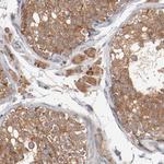 RNase11 Polyclonal Antibody