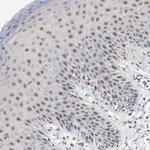 ERICH1 Antibody in Immunohistochemistry (Paraffin) (IHC (P))