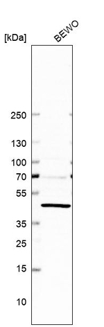 ERICH1 Antibody in Western Blot (WB)