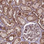 RSPRY1 Polyclonal Antibody