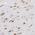 RRAGA/RRAGB Antibody in Immunohistochemistry (Paraffin) (IHC (P))