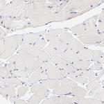 WIPF1 Antibody in Immunohistochemistry (Paraffin) (IHC (P))
