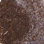 WIPF1 Antibody in Immunohistochemistry (Paraffin) (IHC (P))