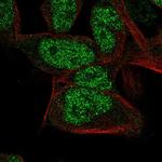 HCE Polyclonal Antibody