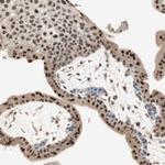 HCE Antibody in Immunohistochemistry (Paraffin) (IHC (P))
