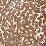 MAGEB17 Polyclonal Antibody