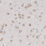 PNMA1 Polyclonal Antibody