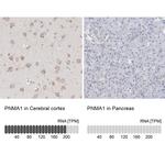 PNMA1 Antibody in Immunohistochemistry (IHC)