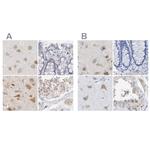 PNMA1 Antibody in Immunohistochemistry (IHC)