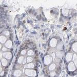 PNMA1 Antibody in Immunohistochemistry (IHC)