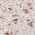 PNMA1 Antibody in Immunohistochemistry (IHC)