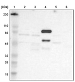 Factor XIII B Antibody in Western Blot (WB)