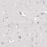 Factor XIII B Polyclonal Antibody