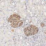 ZNF267 Antibody in Immunohistochemistry (Paraffin) (IHC (P))