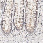 ZNF267 Antibody in Immunohistochemistry (Paraffin) (IHC (P))