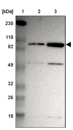 ZNF267 Antibody in Western Blot (WB)