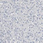 FOXP1 Antibody in Immunohistochemistry (Paraffin) (IHC (P))