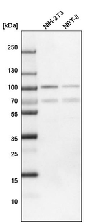 FOXP1 Antibody in Western Blot (WB)