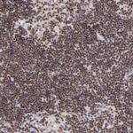 ZFX Polyclonal Antibody