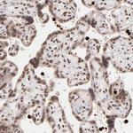 ZFX Antibody in Immunohistochemistry (Paraffin) (IHC (P))