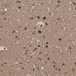 PDZD4 Polyclonal Antibody