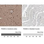 PDZD4 Antibody in Immunohistochemistry (IHC)