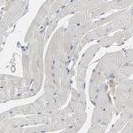 PDZD4 Antibody in Immunohistochemistry (IHC)