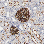 PDLIM2 Antibody in Immunohistochemistry (Paraffin) (IHC (P))